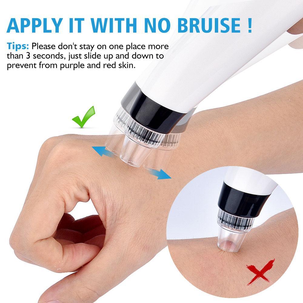 5 In 1 3D Vacuum Electric Blackhead Removal