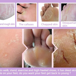 Exfoliating Foot Peel Mask