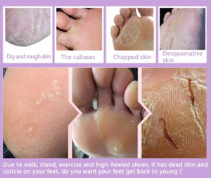 Exfoliating Foot Peel Mask