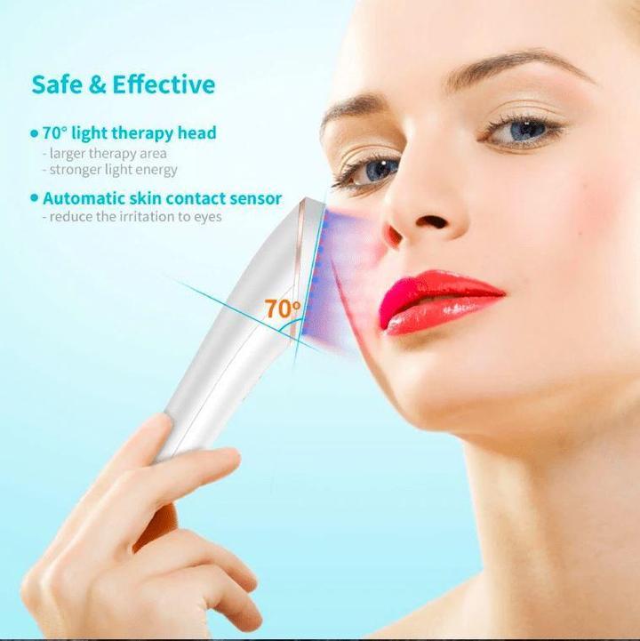 LightStim Acne Light Therapy & Treatment Kit