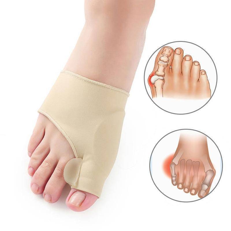 Strictly Cool's Miracle Bunion Corrector (2 pieces)