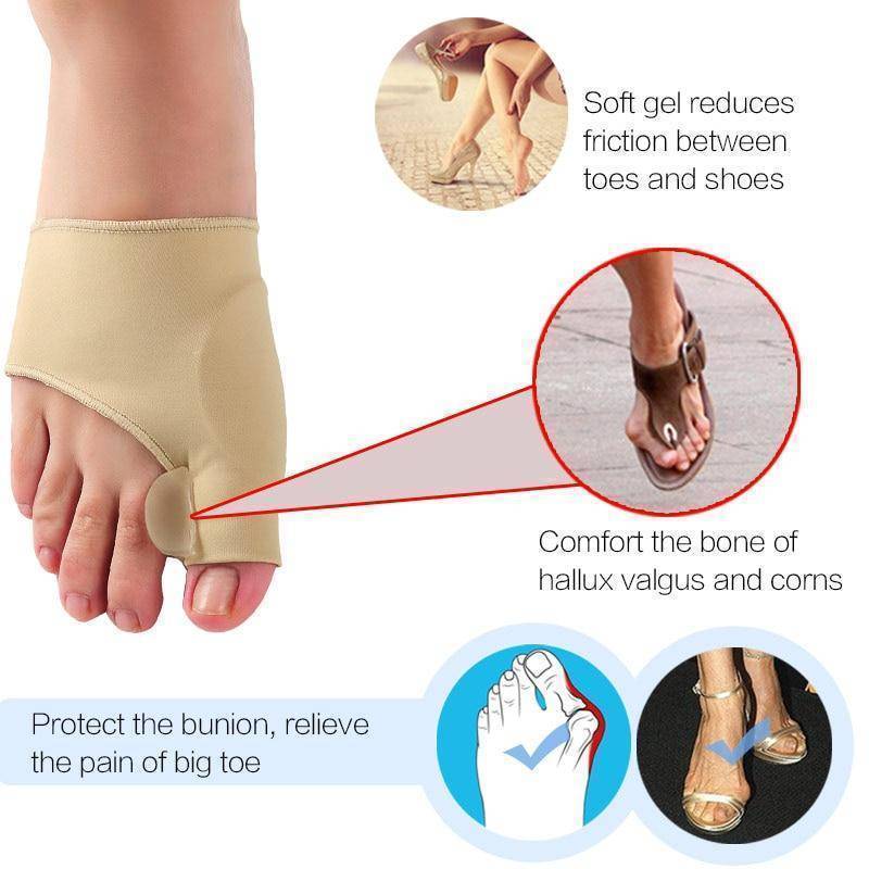 Strictly Cool's Miracle Bunion Corrector (2 pieces)