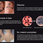 LASER PERMANENT TATTOO REMOVAL AT HOME