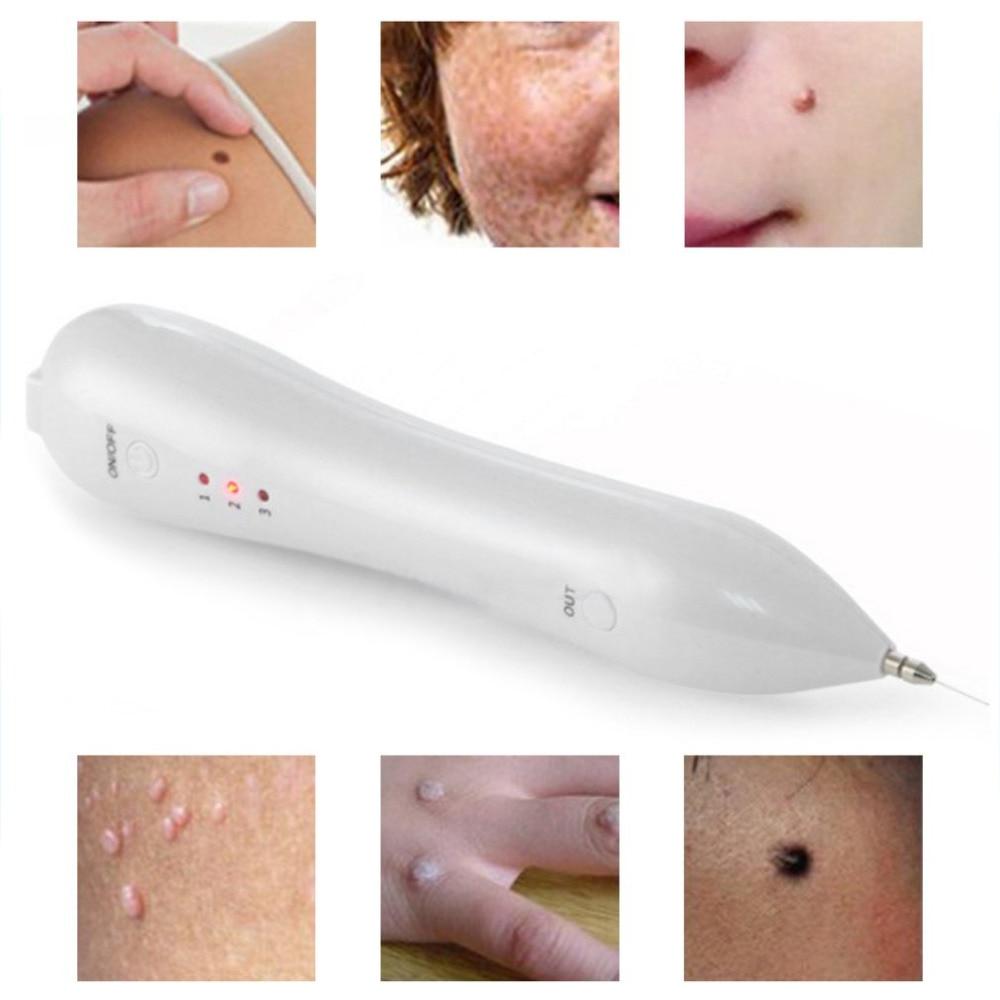 Laser Pen Skin Tag & Mole Remover