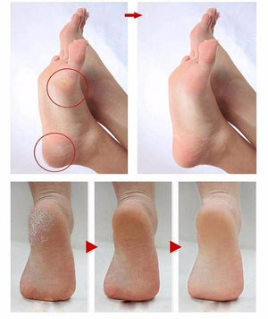 Pedi Electric Foot File