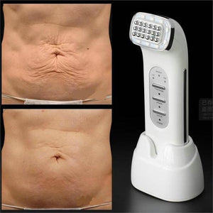 Portable Mini Infrared Thermage RF Skin Tightening Facial Contouring At Home Device