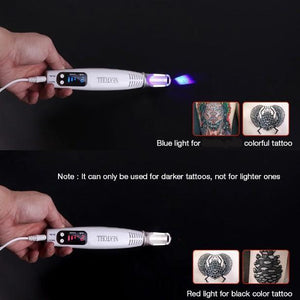 Tattoo Removal Laser Pen