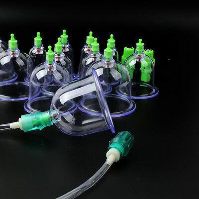 Chinese Vacuum Cupping Therapy Set