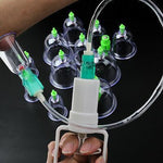 Chinese Vacuum Cupping Therapy Set