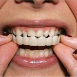 Best Smile Veneers X