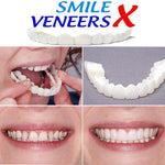 Best Smile Veneers X